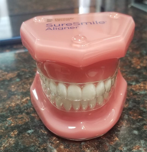 SureSmile® - Clear Braces - Estrella Dental, Elgin Dentist